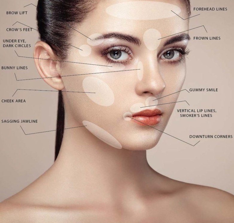 BOTOX